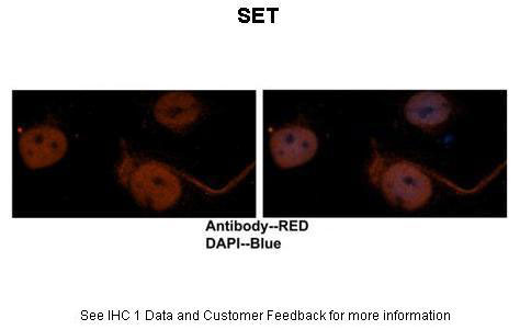 2 - SET antibody - N-terminal region AI13959
