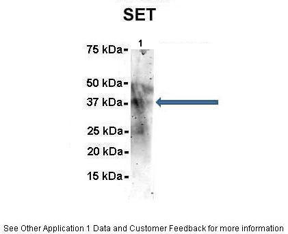 5 - SET antibody - N-terminal region AI13959