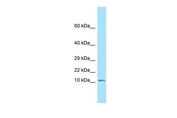 1 - Ndufs6 antibody - N-terminal region AI13965