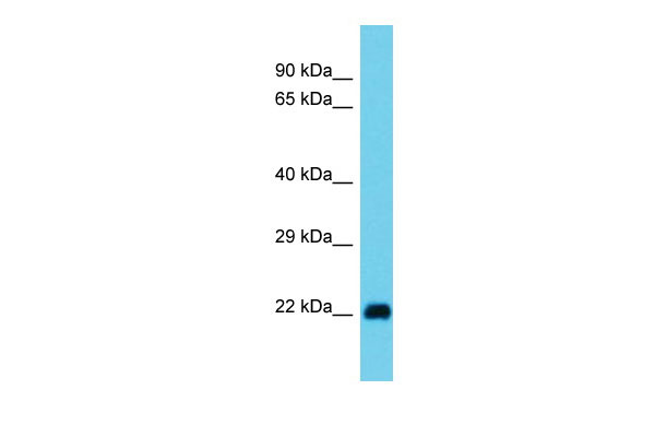 1 - Rala Antibody - N-terminal region AI13975