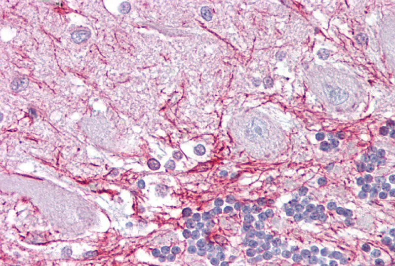 2 - RP2 antibody - middle region AI13992