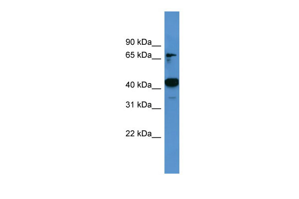 1 - Ascc1 antibody - C-terminal region AI14002