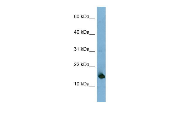 1 - MED31 antibody - N-terminal region AI14009