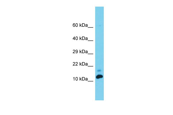 1 - Med31 Antibody - C-terminal region AI14010