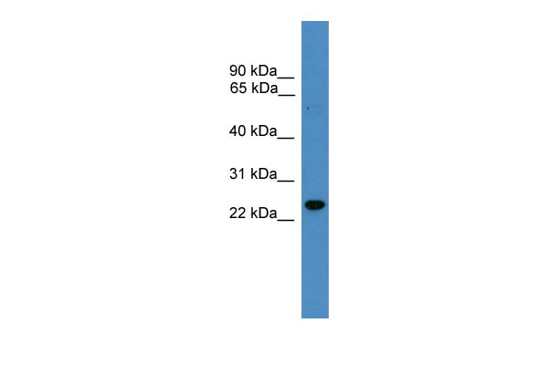 1 - RAB9B antibody - N-terminal region AI14027