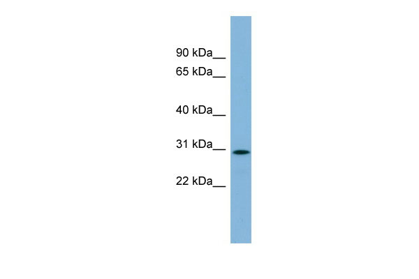 1 - C11orf57 antibody - middle region AI14062