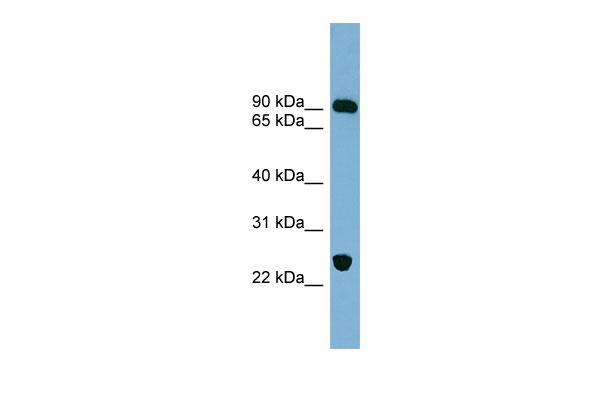 1 - VPS53 antibody - middle region AI14070