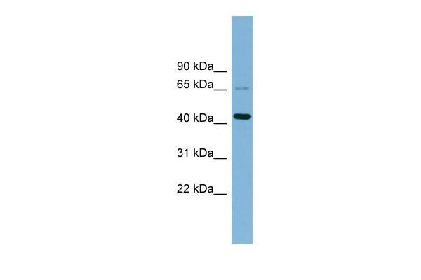 1 - UEVLD antibody - middle region AI14071