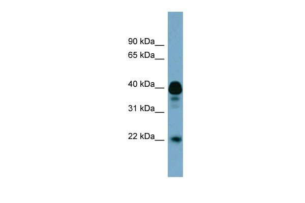 1 - FAM45B antibody - middle region AI14085