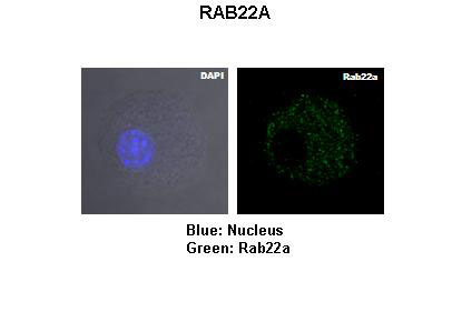 2 - RAB22A antibody - middle region AI14117