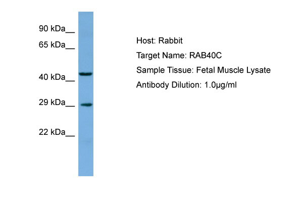 1 - RAB40C Antibody - C-terminal region AI14139