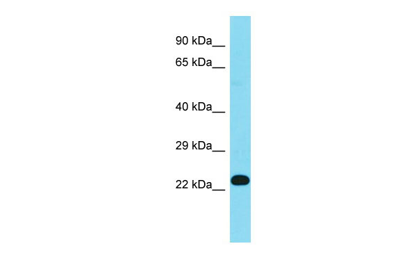 1 - Fn3k Antibody - N-terminal region AI14158