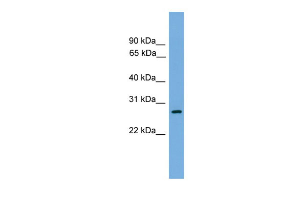 1 - ATPAF1 antibody - N-terminal region AI14168