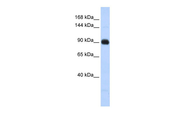 1 - MATN2 antibody - middle region AI14174