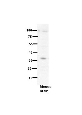 1 - TMPRSS3 antibody - N-terminal region AI14177
