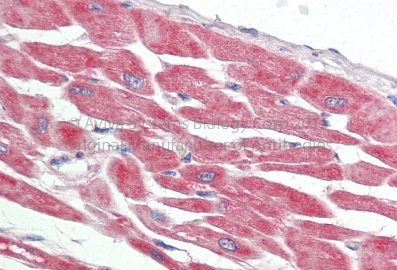2 - PRKACA antibody - N-terminal region AI14206