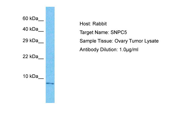 1 - SNPC5 Antibody - C-terminal region AI14224