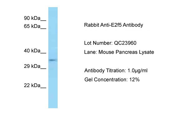 1 - E2f5 antibody - C-terminal region AI14232