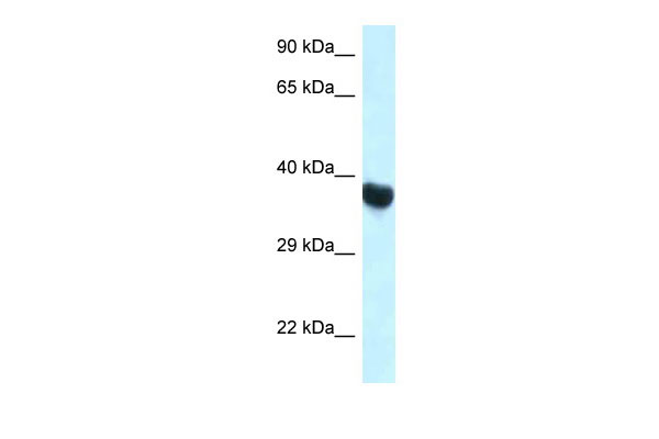 1 - Hoxa10 antibody - C-terminal region AI14256