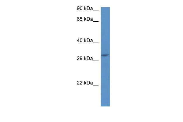 1 - Jmjd8 antibody - C-terminal region AI14261