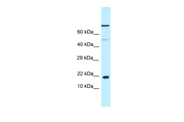 1 - LOC683991 antibody - middle region AI14304