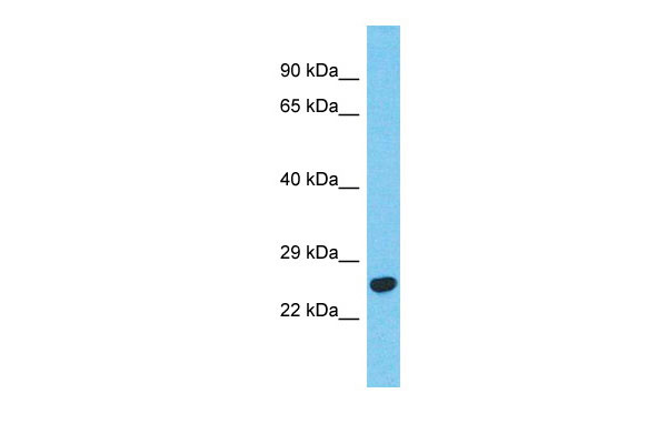 1 - BCKDHB Antibody - N-terminal region AI14309