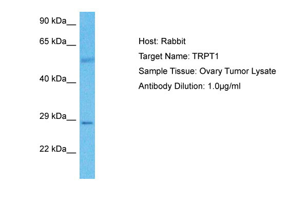 1 - TRPT1 Antibody - C-terminal region AI14537