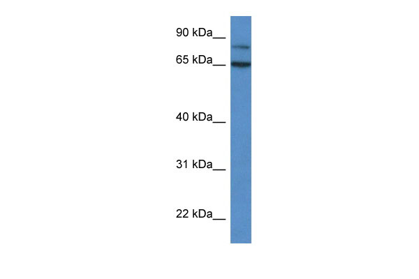 1 - IRAK2 antibody - C-terminal region AI14635