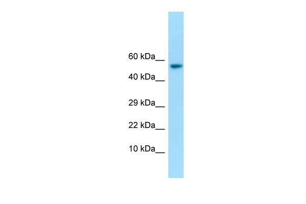 1 - IFIT1 Antibody - C-terminal region AI14695