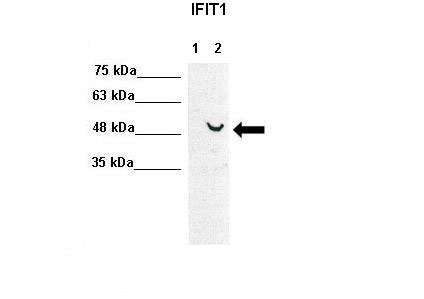 1 - IFIT1 Antibody - C-terminal region AI14695