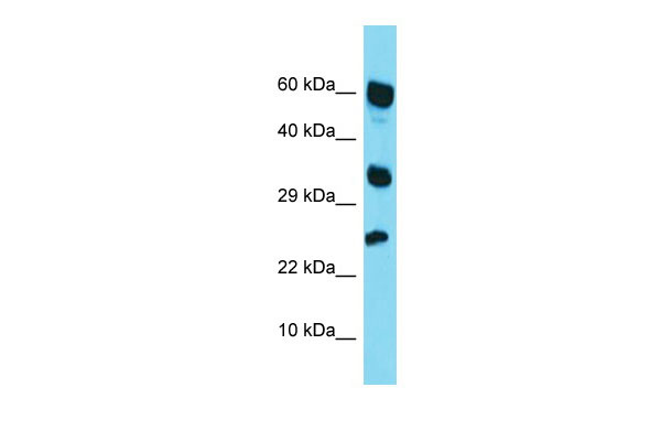 1 - RARRES1 Antibody - middle region AI14717