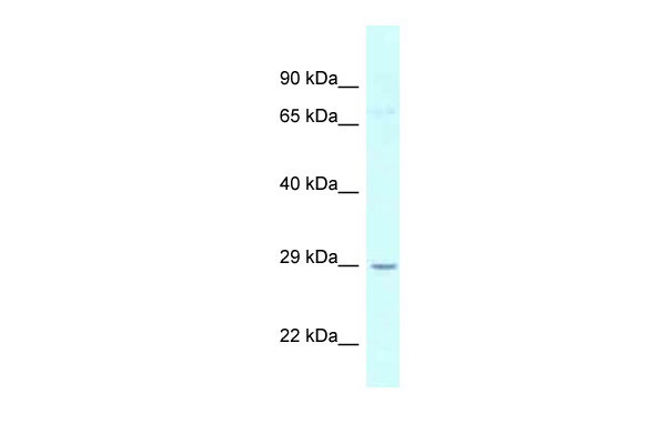 1 - UCK1 antibody - N-terminal region AI14723