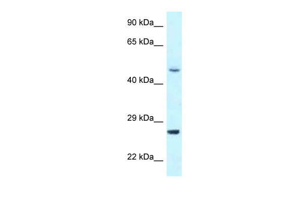 1 - CDK20 antibody - N-terminal region AI14786