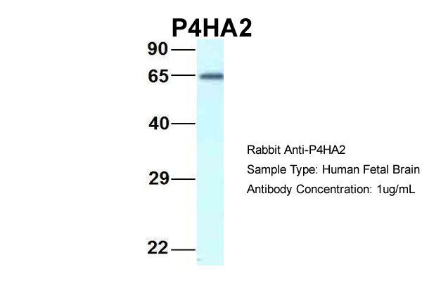 1 - P4HA2 antibody - C-terminal region AI14788