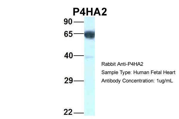 1 - P4HA2 antibody - C-terminal region AI14788