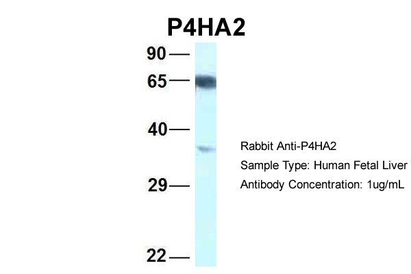 1 - P4HA2 antibody - C-terminal region AI14788