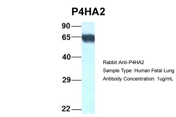 1 - P4HA2 antibody - C-terminal region AI14788