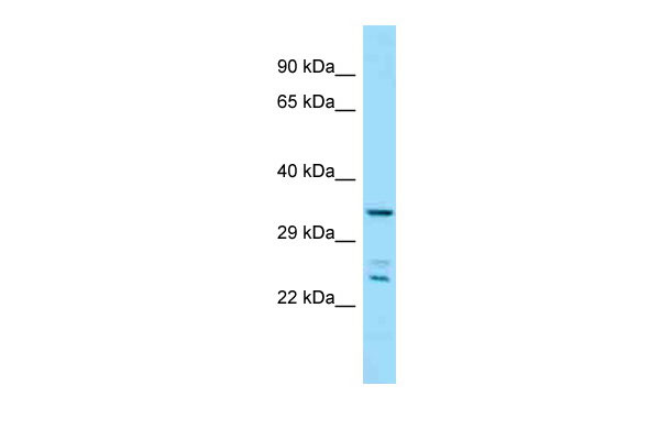 1 - Pitpnc1 antibody - middle region AI14814