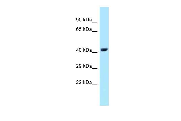 1 - UBE2Q1 antibody - middle region AI14894