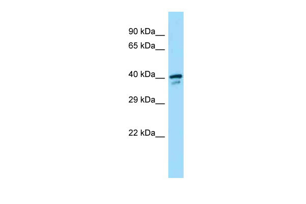 1 - Sms antibody - middle region AI14911