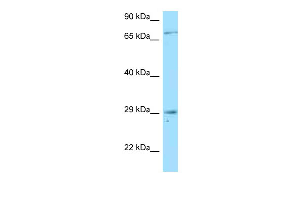 1 - TNFRSF13B antibody - N-terminal region AI14999