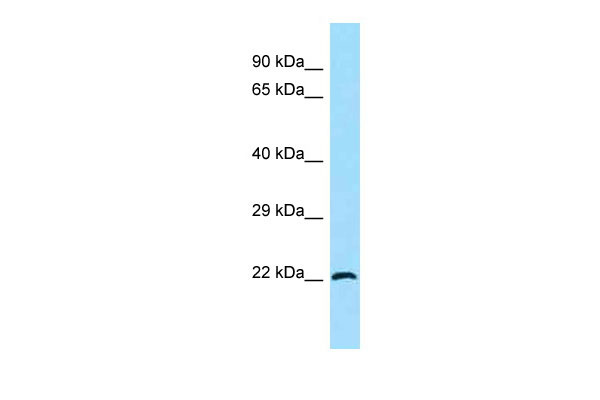 1 - DKFZp779C2259 Antibody - middle region AI15046