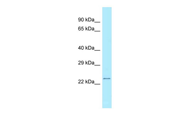 1 - RPS5 antibody - C-terminal region AI15051