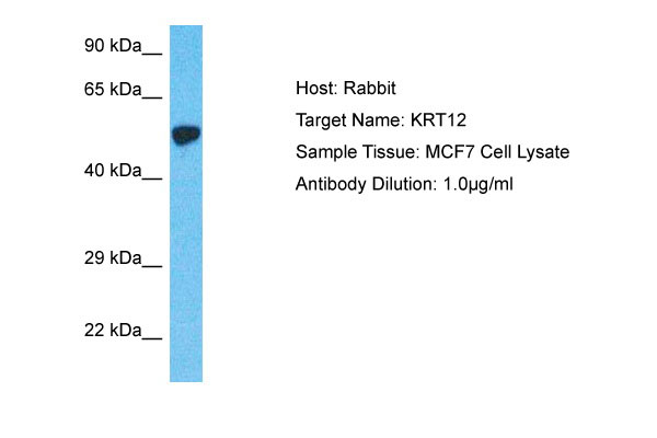 1 - KRT12 Antibody - N-terminal region AI15097