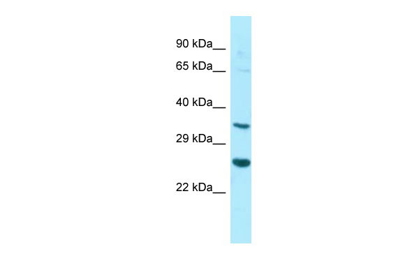 1 - HYI antibody - N-terminal region AI15107