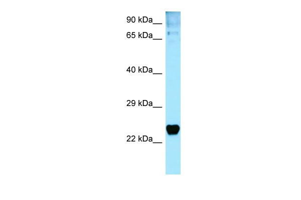 1 - TP53I3 Antibody - C-terminal region AI15114