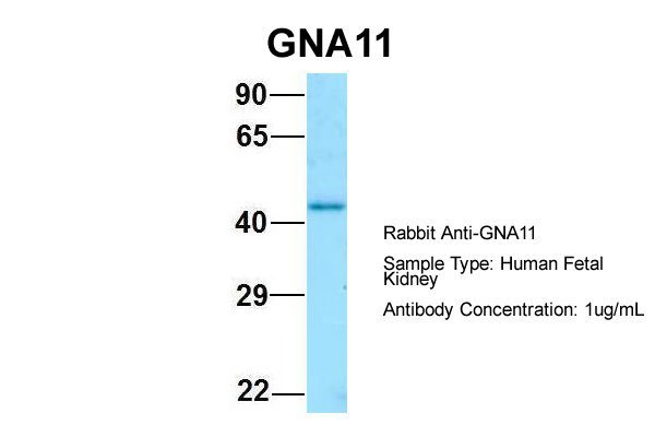 1 - GNA11 antibody - C-terminal region AI15176