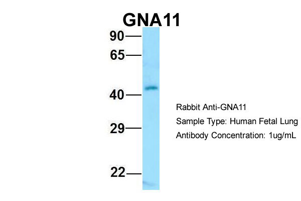 1 - GNA11 antibody - C-terminal region AI15176