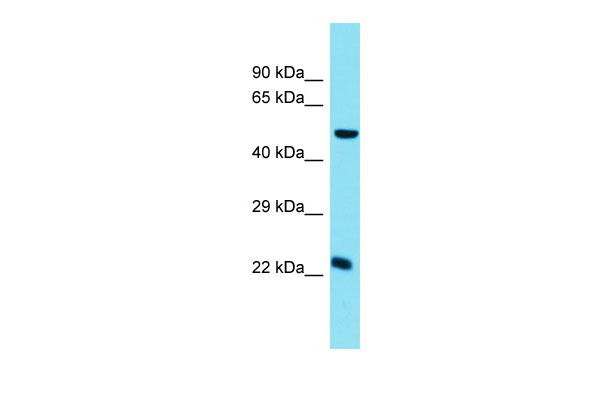 1 - Chmp5 Antibody - C-terminal region AI15283