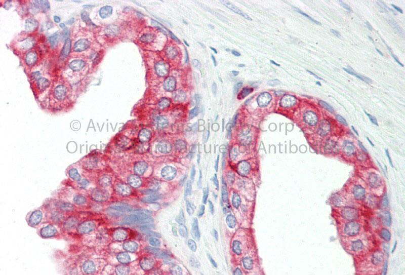 2 - KRT8 Antibody - middle region AI15335